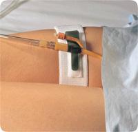 Dale Foley Cath Holder, Leg Band 2in x 19.5in - Each