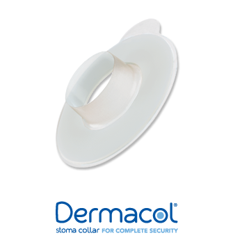Salts Healthcare Dermacol Stoma Collar, Fits Stoma Size 39 mm - 41 mm - Box of 30