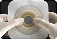 Convatec Natura Moldable Durahesive, Flange 2 3/4in (70 mm), Cut-to-fit 1-5/16in (33 mm) - 1 3/4in (45 mm) - Box of 10